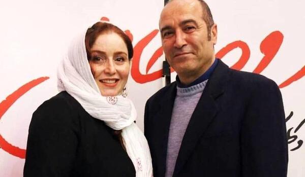 عکس ژاله صامتی قبل از عمل زیبایی