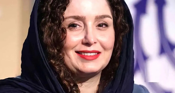 عکس ژاله صامتی قبل از عمل زیبایی