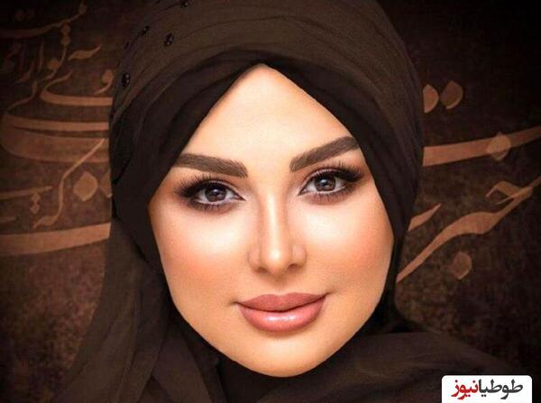 عکس ژاله صامتی قبل از عمل زیبایی