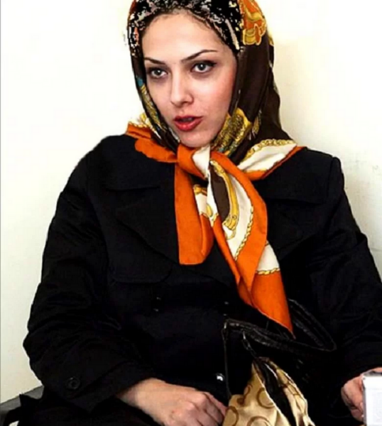 عکس ژاله صامتی قبل از عمل زیبایی