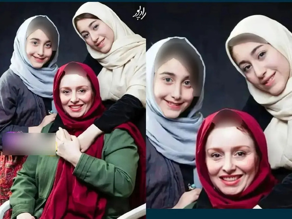 عکس ژاله صامتی قبل از عمل زیبایی