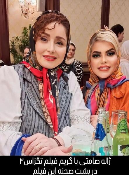 عکس ژاله صامتی قبل از عمل زیبایی