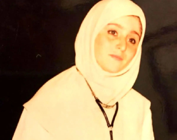 عکس ژاله صامتی قبل از عمل زیبایی