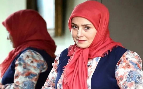 عکس ژاله صامتی قبل از عمل زیبایی