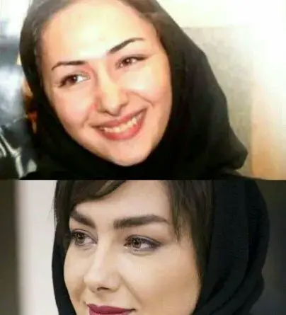 عکس ژاله صامتی قبل از عمل زیبایی