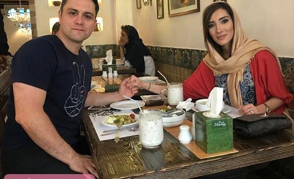 عکس قبل عمل صدف بیوتی