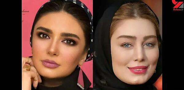 عکس نود سلبریتی ها