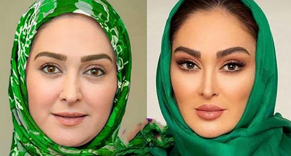 عکس ساناز حمیدی