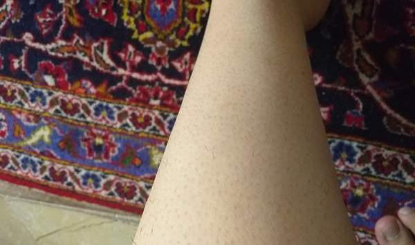 عکس سوتی های لیزر نی نی سایت