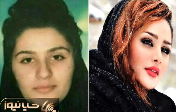 عکس دنیا جهانبخت قبل عمل زیبایی