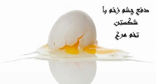 عکس آیه چشم نظر