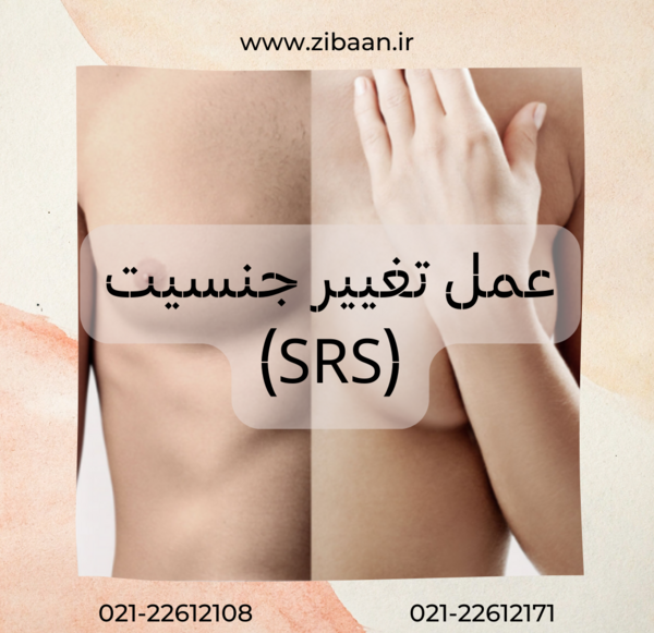 عکس عمل ترنس ها