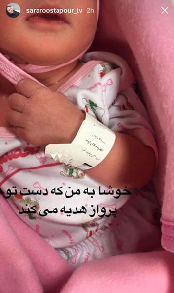 عکس سارا روستاپور قبل از عمل بینی