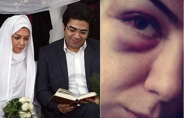 عکس همسر جدید فرزاد حسنی