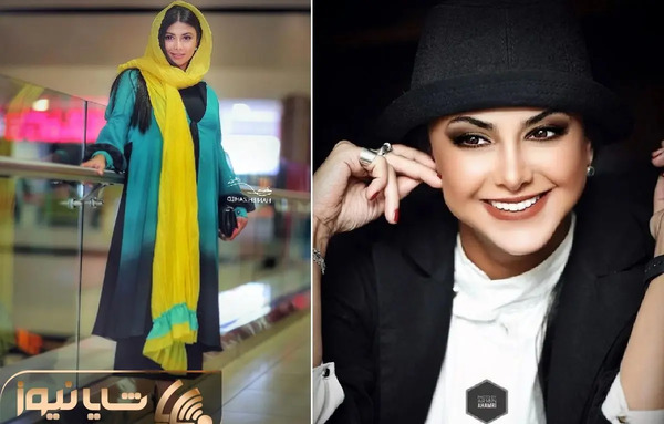 عکس آزاده صمدی قبل از عمل بینی