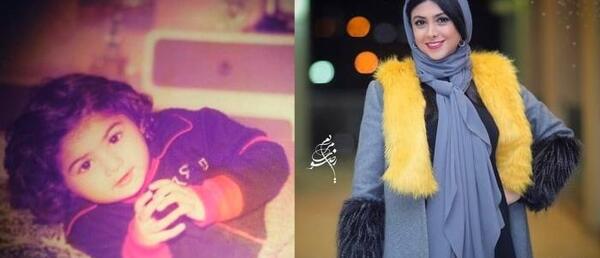 عکس آزاده صمدی قبل از عمل بینی