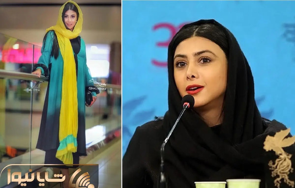 عکس آزاده صمدی قبل از عمل بینی