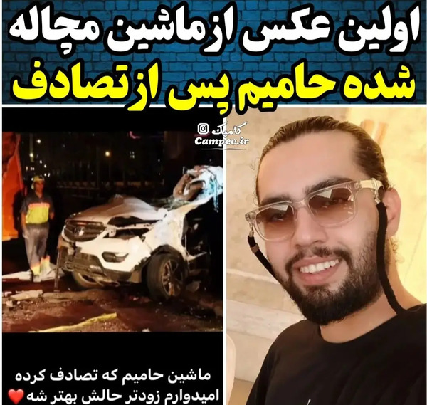 عکس حامیم بعد عمل