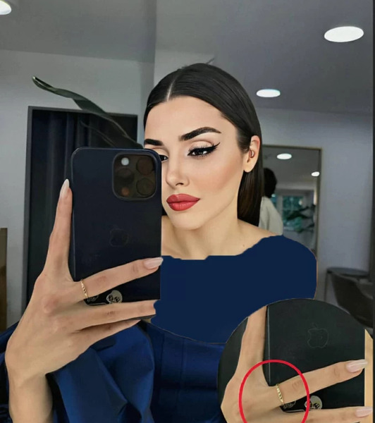 عکس تتودست هانده ارچل