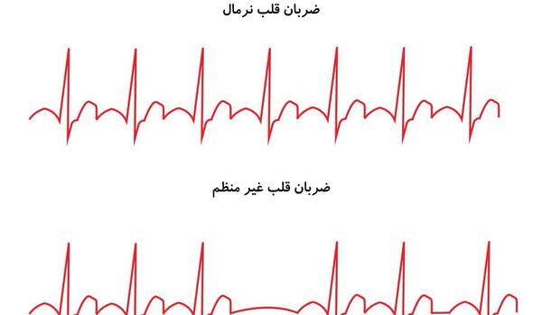 عکس ضربان قلب بالا