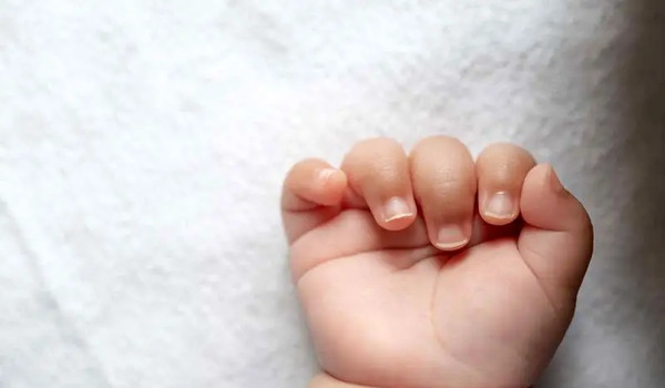 عکس نوزاد ادم قورباغه ای