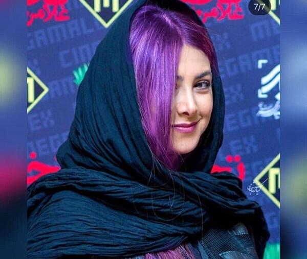 عکس آزاده صمدی قبل از عمل زیبایی