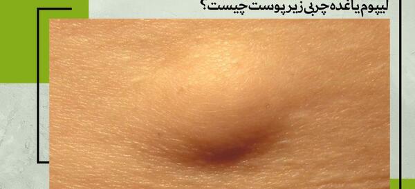 عکس غده روی سر