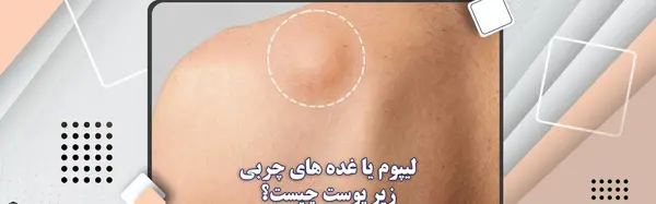 عکس غده روی سر