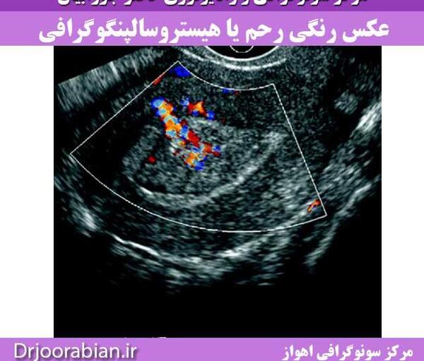 فیلم عکس رنگی رحم