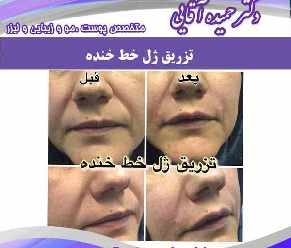 عکس های نوشته حمیده