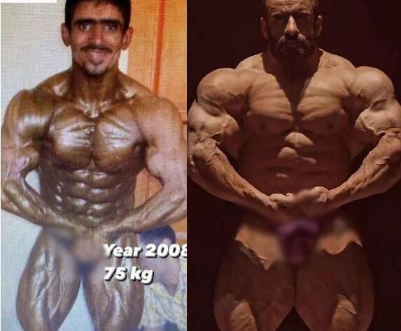 عکس هادی چوپان قدیمی