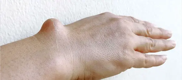 عکس بافت نرم