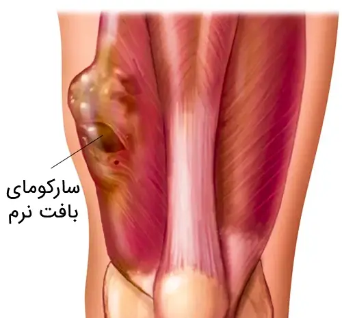 عکس بافت نرم