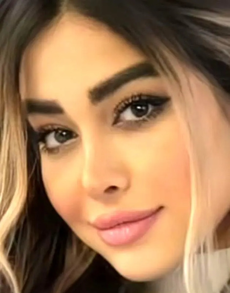 عکس حامیم هنگام تصادف