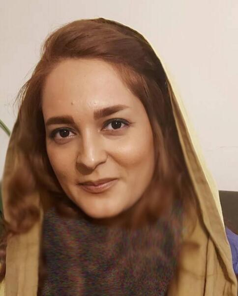 عکس سانیا سالاری قبل از عمل