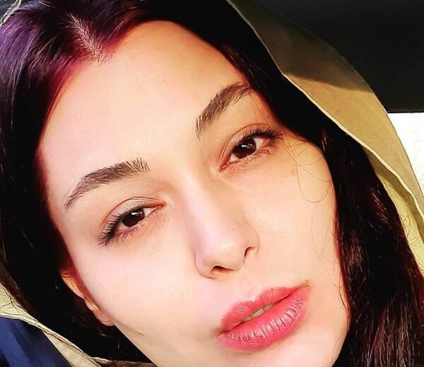عکس سانیا سالاری قبل از عمل