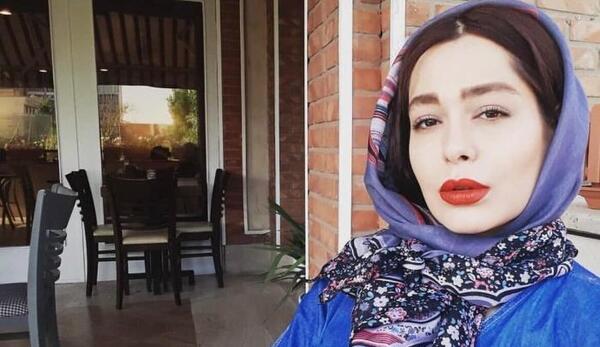 عکس سانیا سالاری قبل از عمل