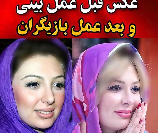 عکس سانیا سالاری قبل از عمل
