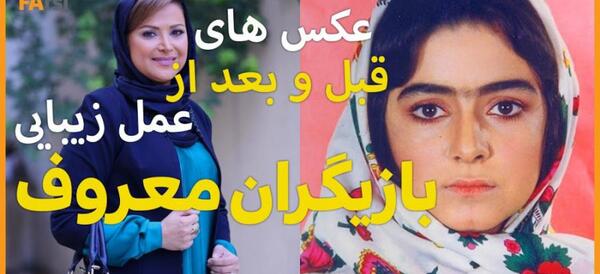 عکس سانیا سالاری قبل از عمل