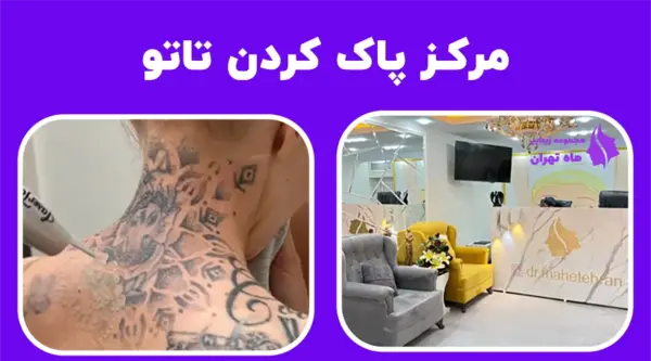 عکس تاتو در تهران