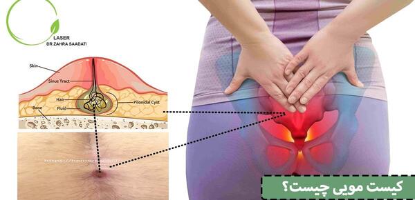 عکس چاقو رو کمر