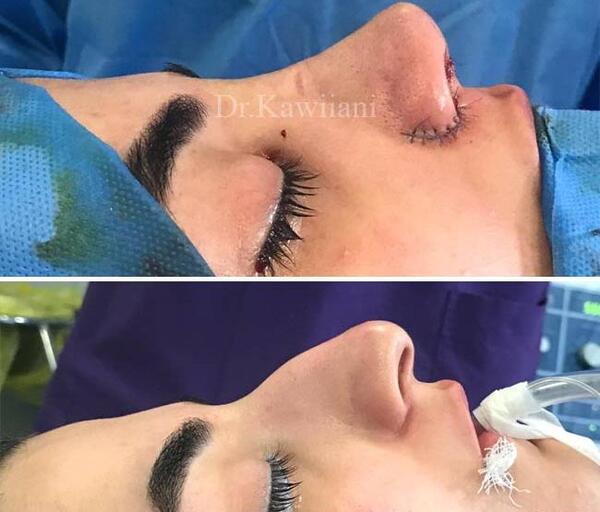 عکس دختر خوشگل عملی