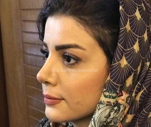 عکس دختر خوشگل عملی