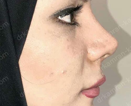 عکس دختر خوشگل عملی
