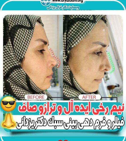 عکس غزال خطایی