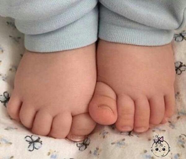عکس دست و پای نی نی تپل