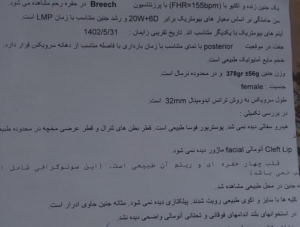 عکس سونو پسر نی نی سایت