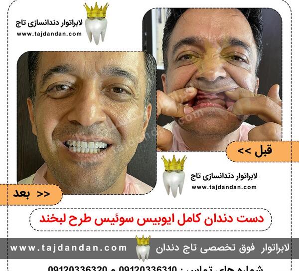 عکس حمید دندانساز