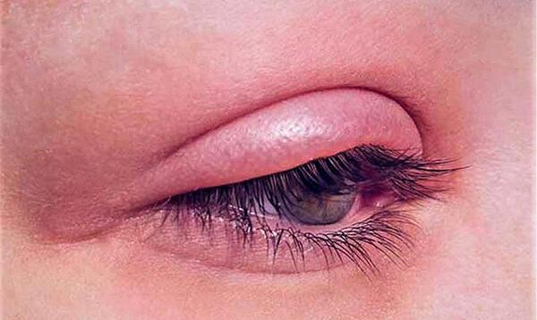 عکس فانتزی لیفت مژه و ابرو
