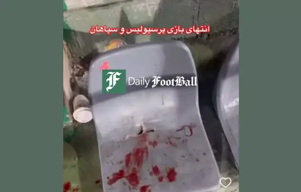عکس فیک خون دماغ